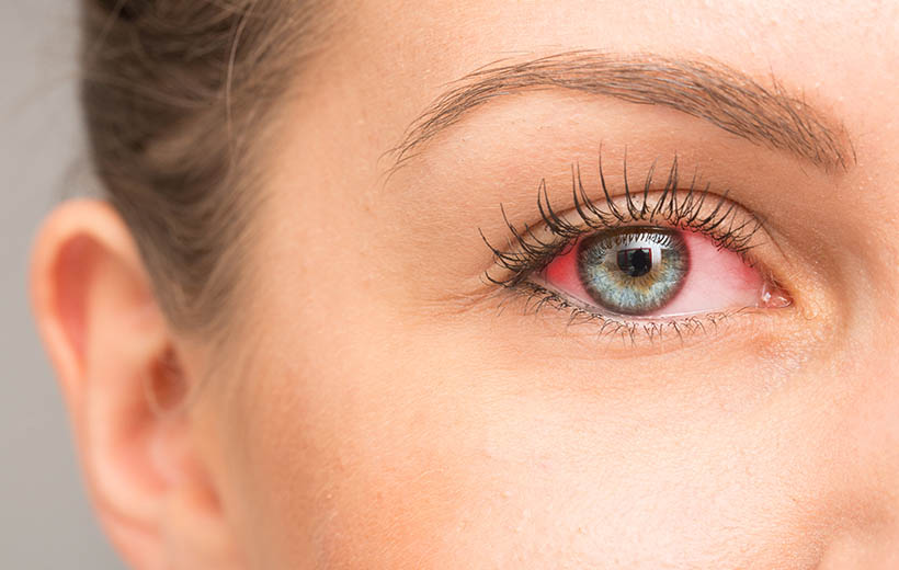 Атеросклероз сетчатки глаза, причины и стадии возникновения