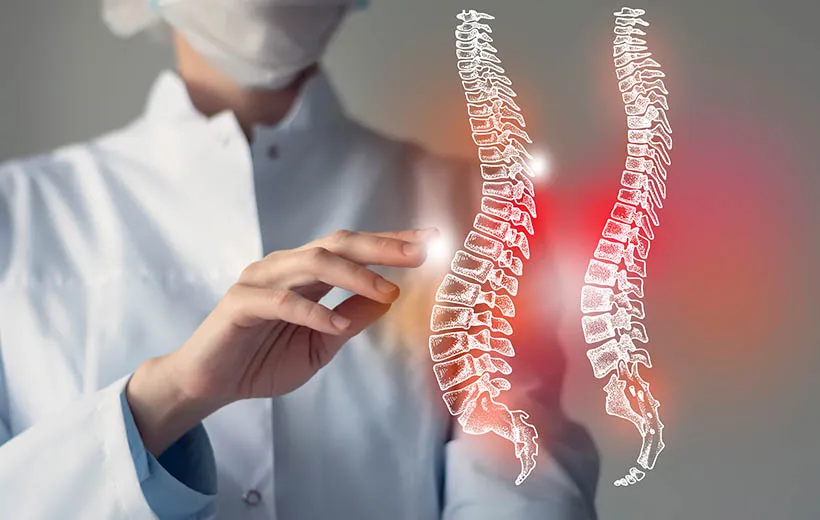 Лордоз Лордоз